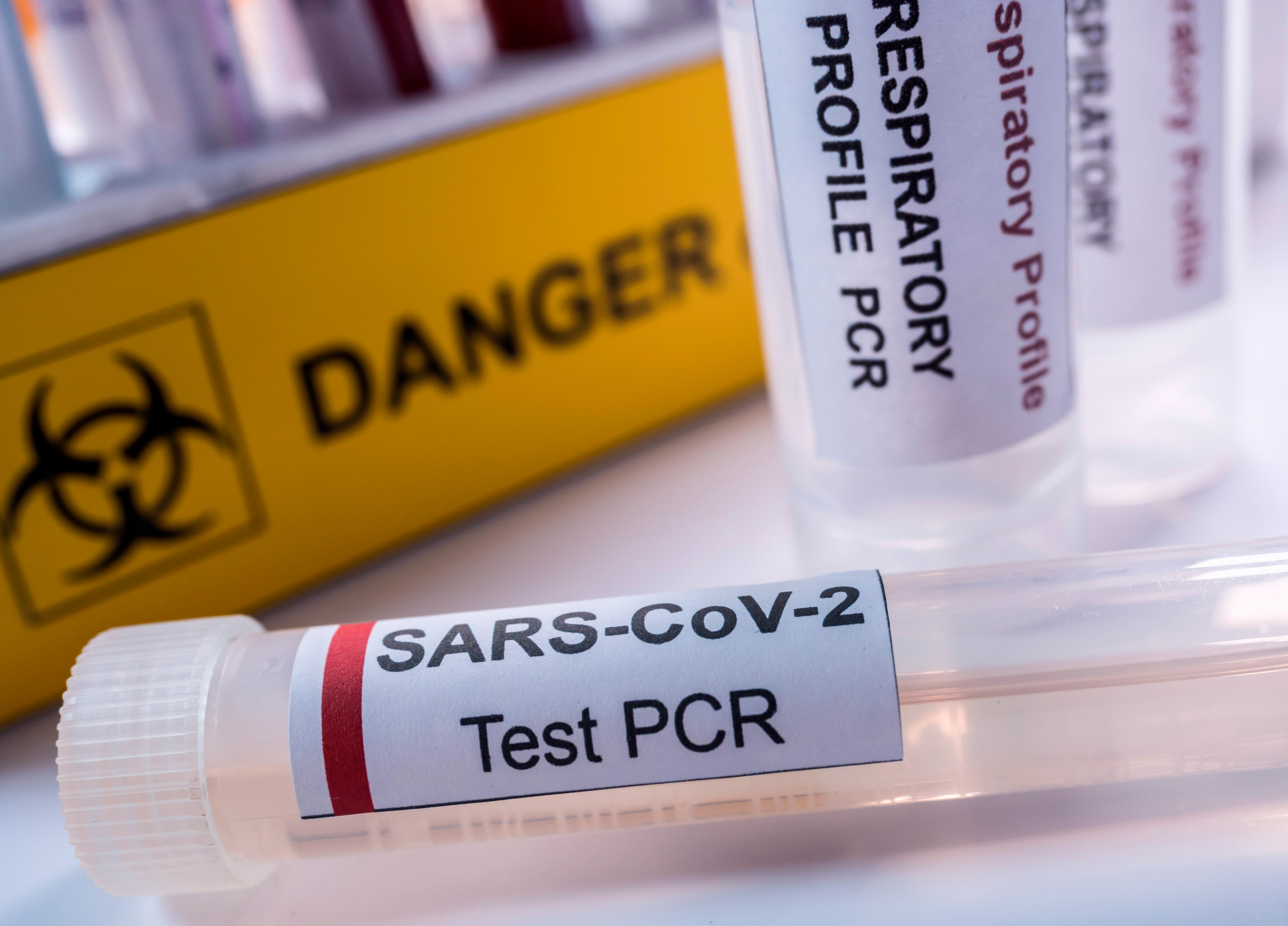 coronavirus conceptual image coronavirus conceptual image